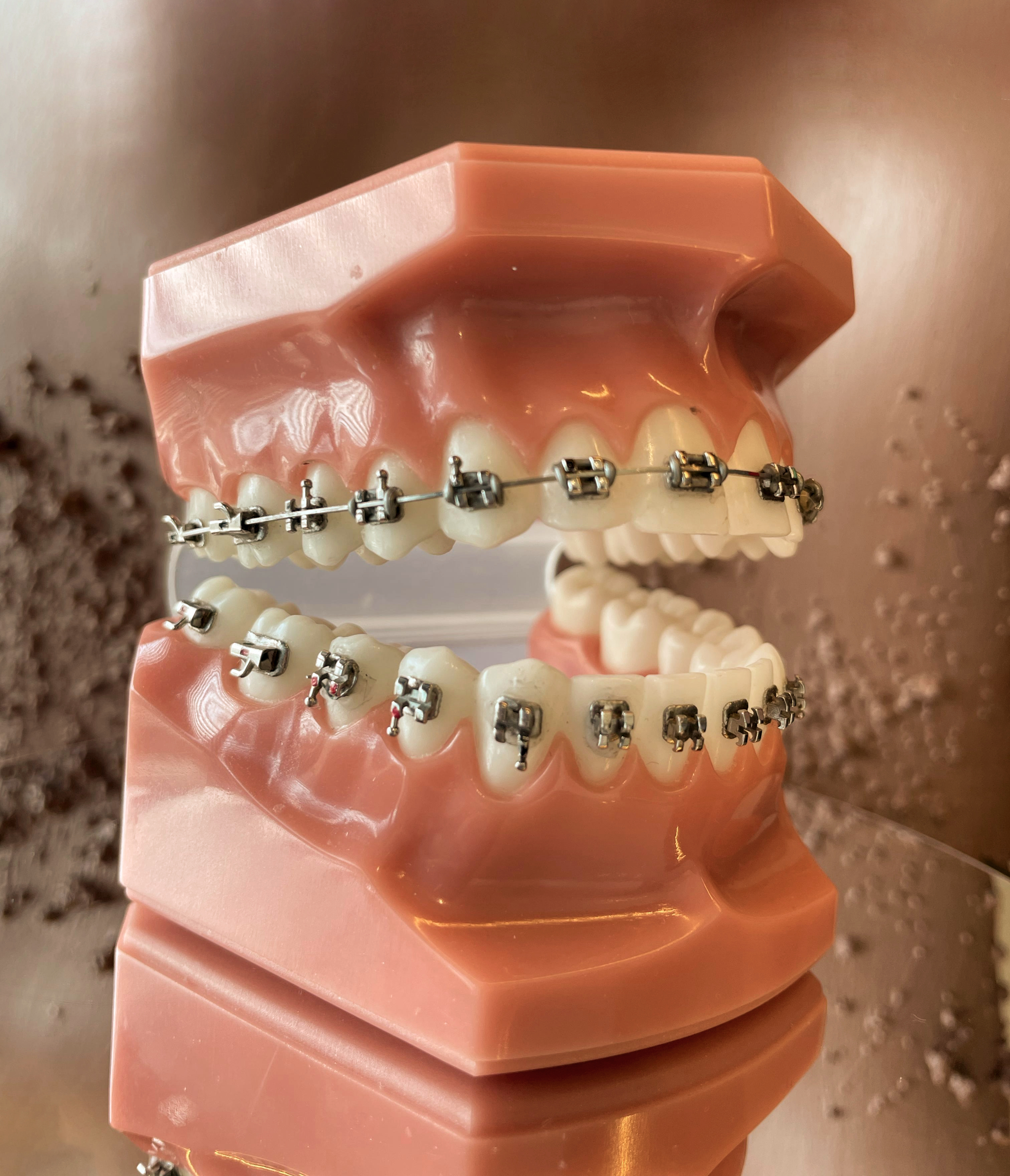Braces