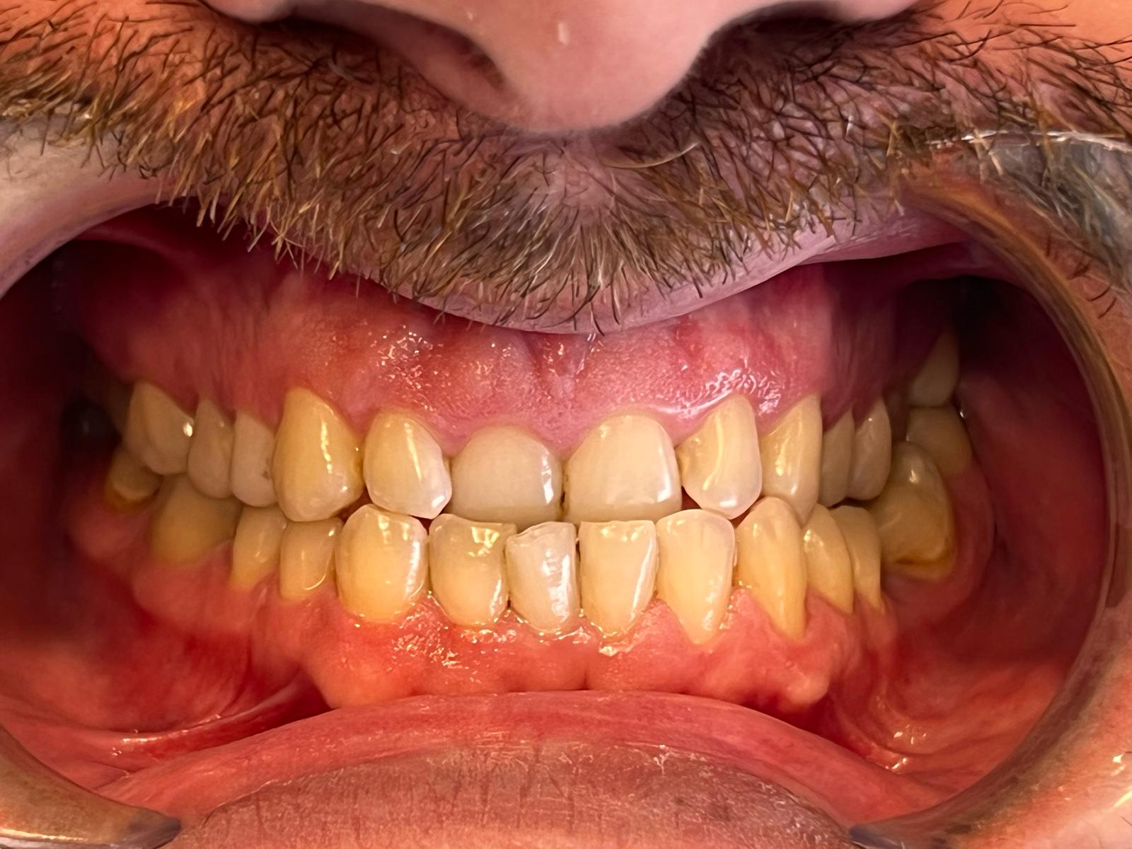 Orthodontics for Kids